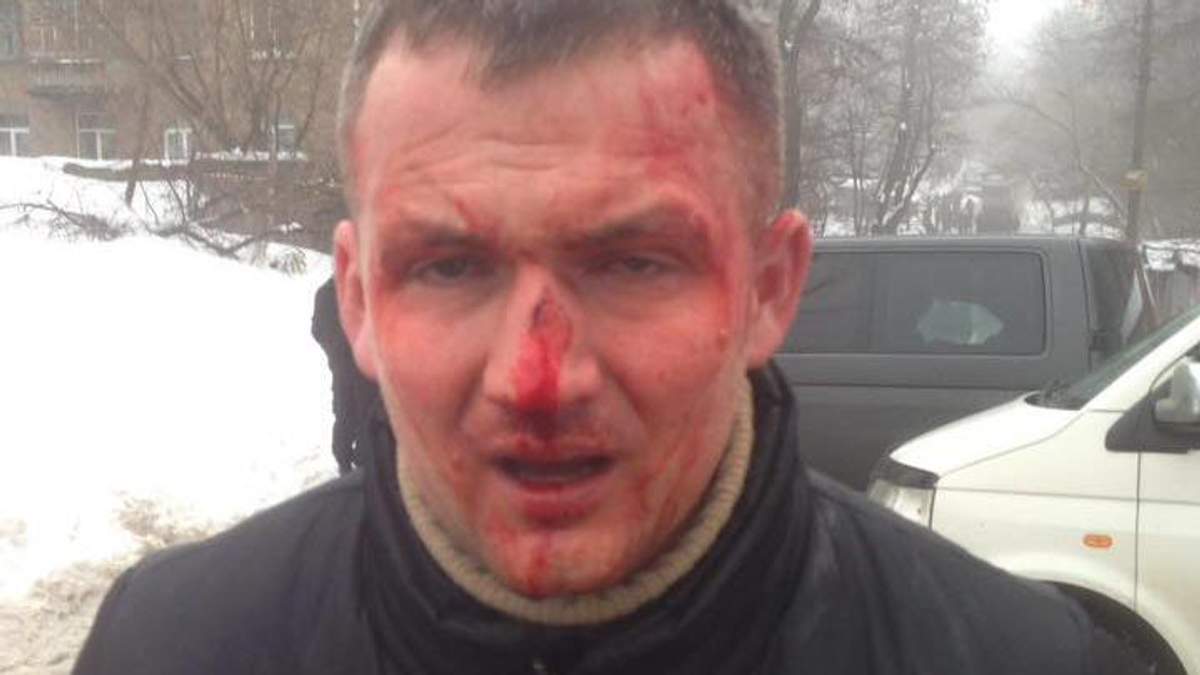 Нардеп Левченко після побиття Нардеп Левченко після побиття