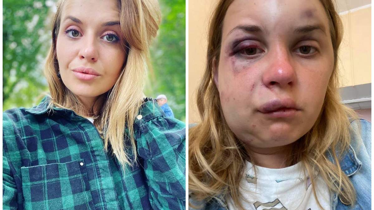 Нападение в поезде Мариуполь – Киев На Анастасию Луговую 1 августа 2020 – Нападение в поезде Мариуполь – Киев На Анастасию Луговую 1 августа 2020 –